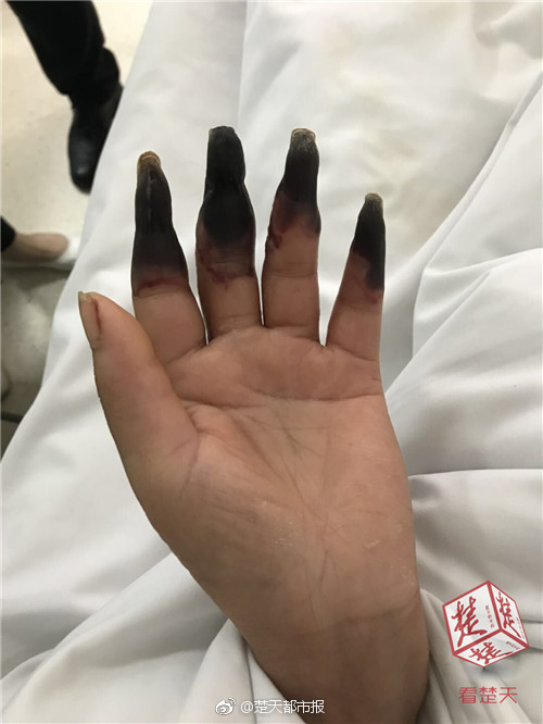 辣椒直播